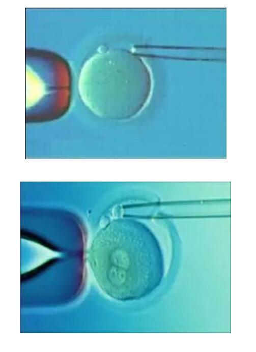 邵阳试管婴儿医院胚胎植入前遗传学诊断技术应用