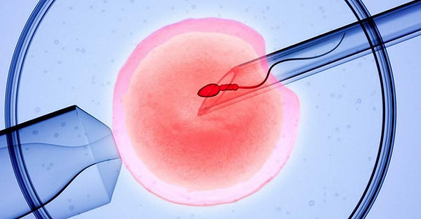 迟迟不孕的病因及治疗策略