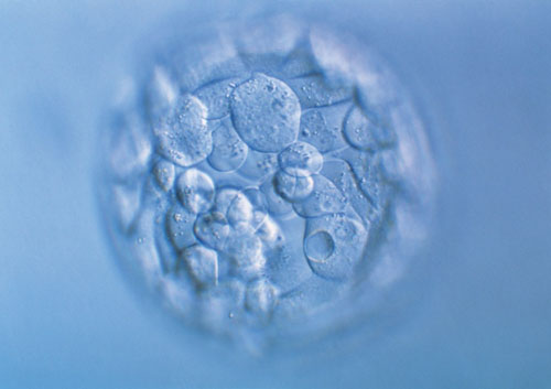 郑州不孕不育医院治疗方案